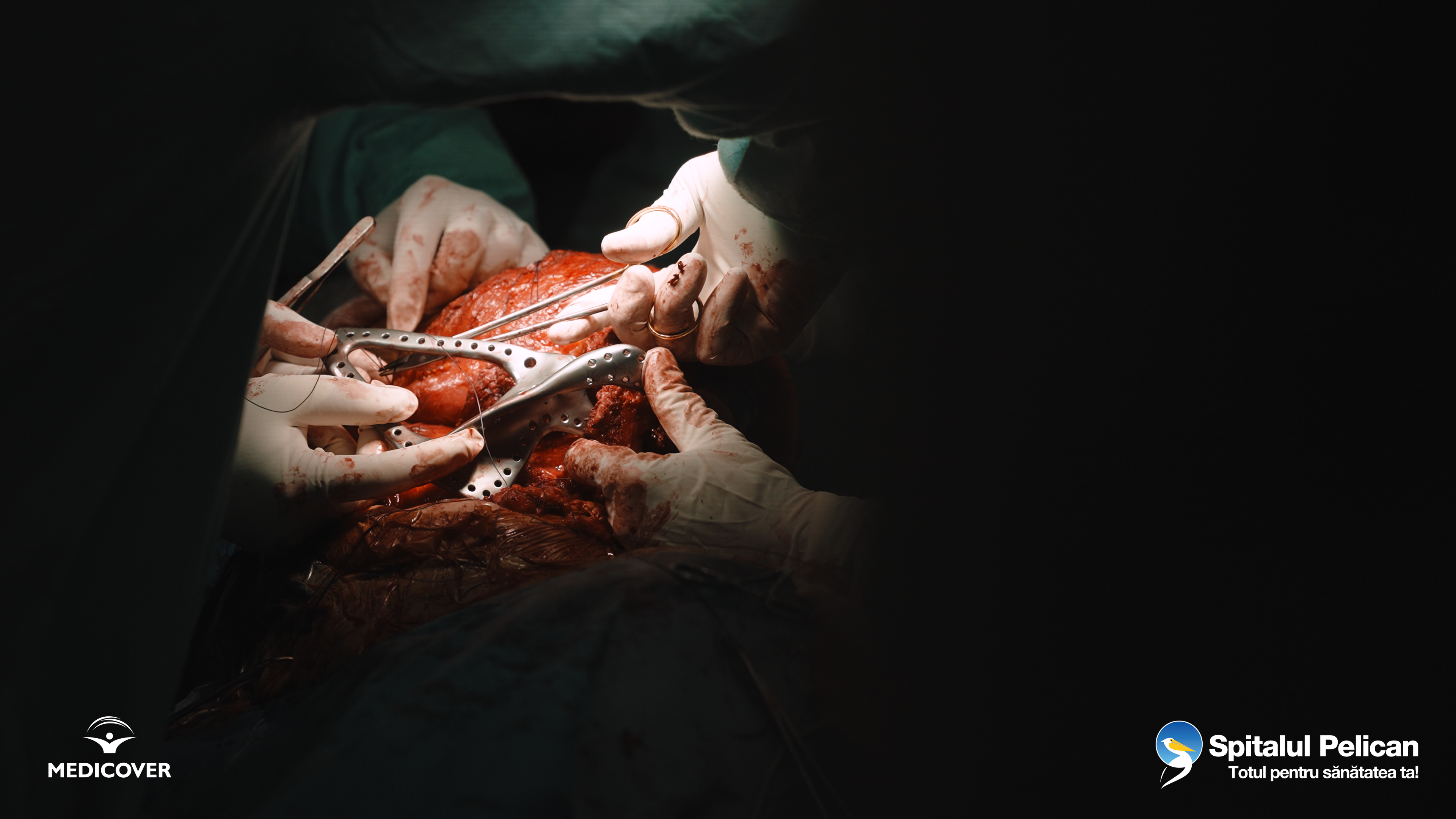 Dr_Adyb_Interventie_Live_Surgery_2