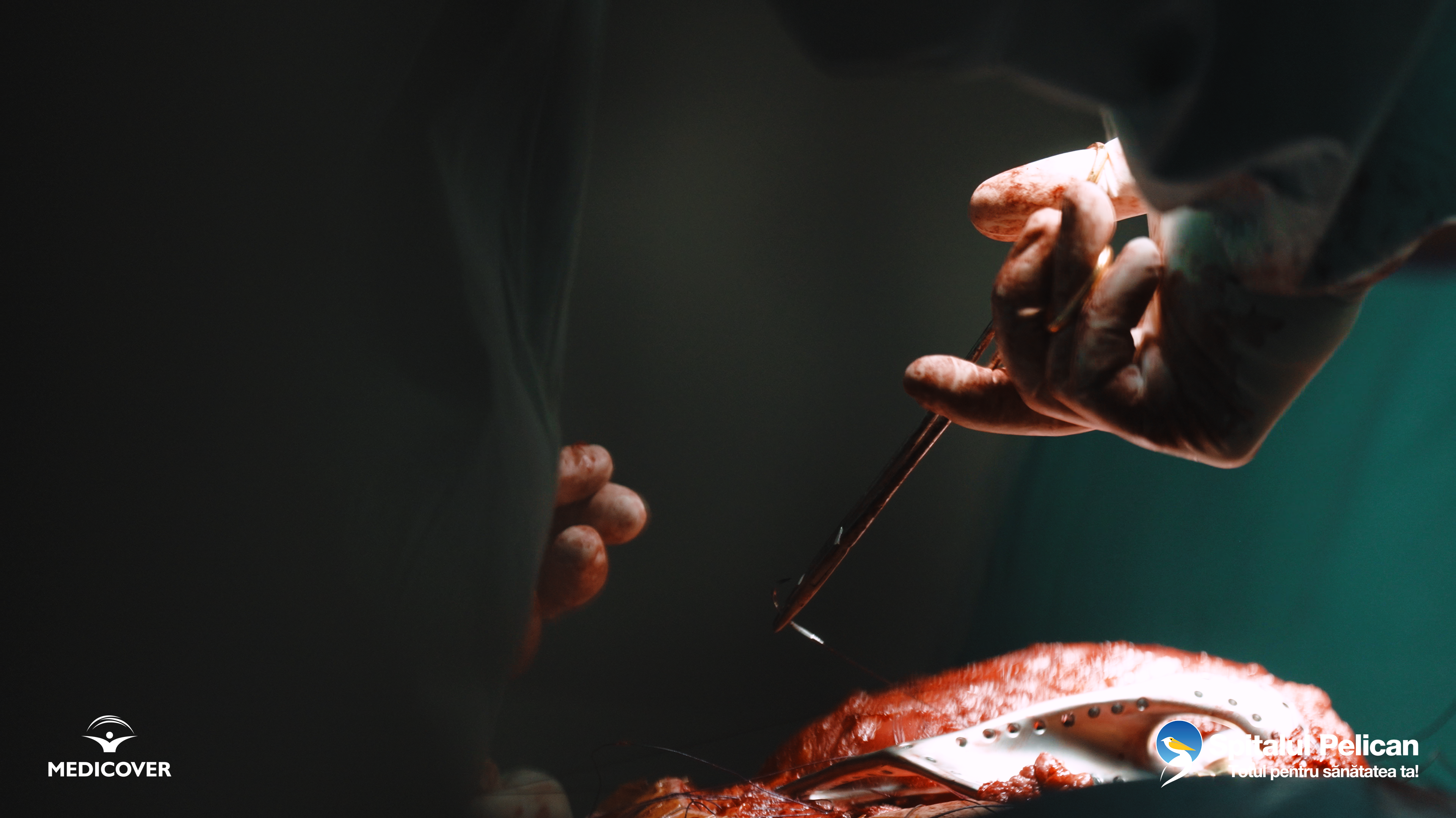 Dr_Adyb_Interventie_Live_Surgery_5
