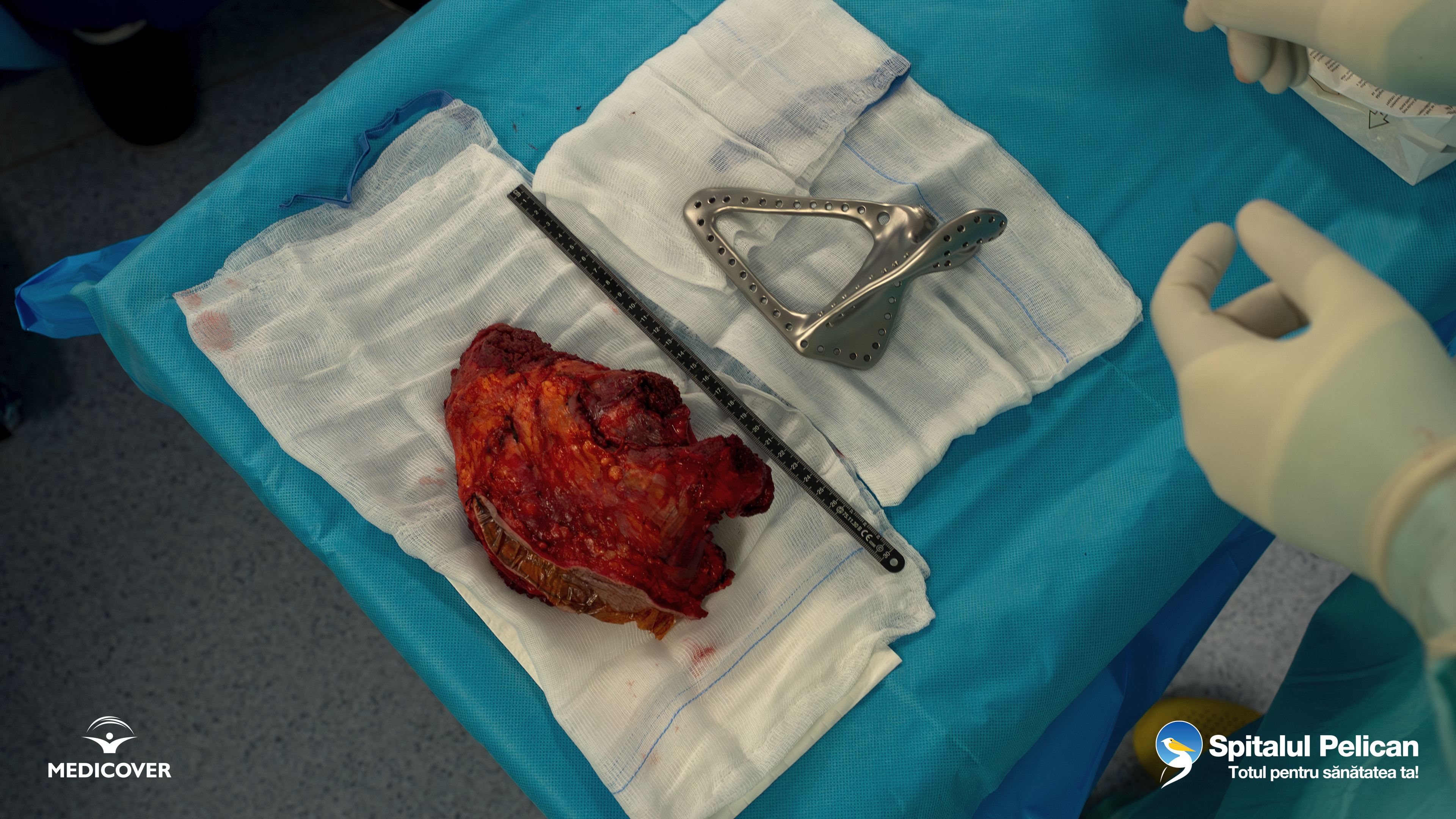 Dr_Adyb_Interventie_Live_Surgery_17